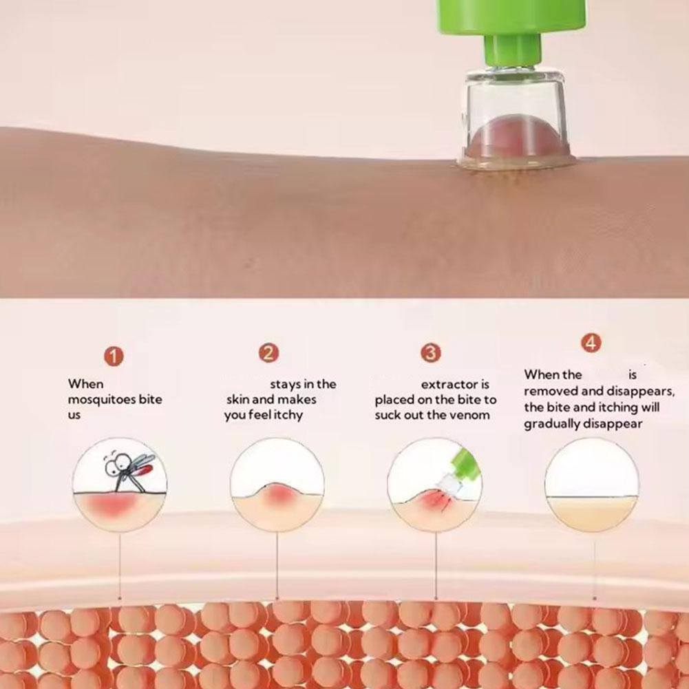 Emergency For Insect Bites Vacuum Negative Pressure Extractor Insect Bite Emergency Treatment For Outdoor Camping Hiking