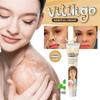 Behandlungscreme, antibakterielle Mittel, Psoriasis, lokalisierte Salbe, Mykose, Leukoplakie, Pflaster, Creme gegen weiße Flecken