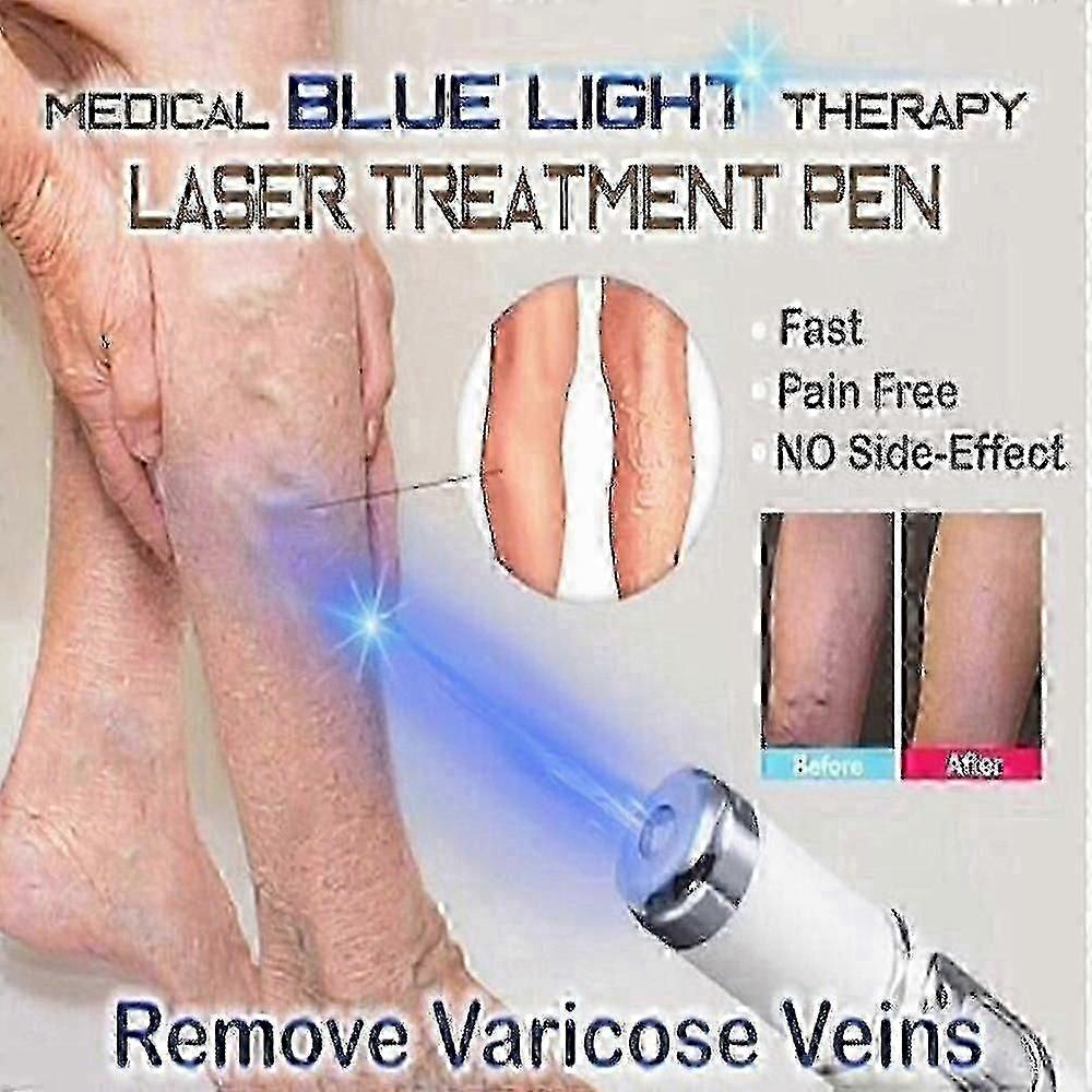 Laser Pen for Spider Vein Removal and Wrinkle Treatment