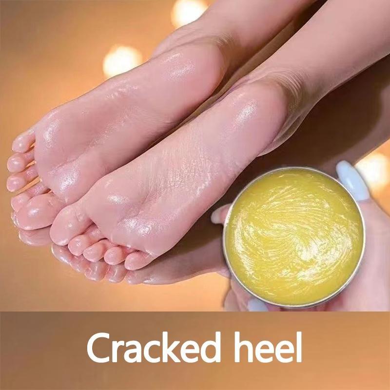 Anti-Riss-Fußcreme, rissige Haut, Reparaturcreme, Trockenheit, Ferse, rissige Peeling, Reparatur, Fußmaske, Lebensmittel, erweichen, feuchtigkeitsspendendes Lotin