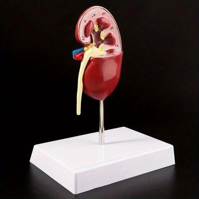 Medical Props Model Life Size Human Kidney Diseased Model Anatomical Anatomy Diseased Pathological Stone Organ Teaching Supplies