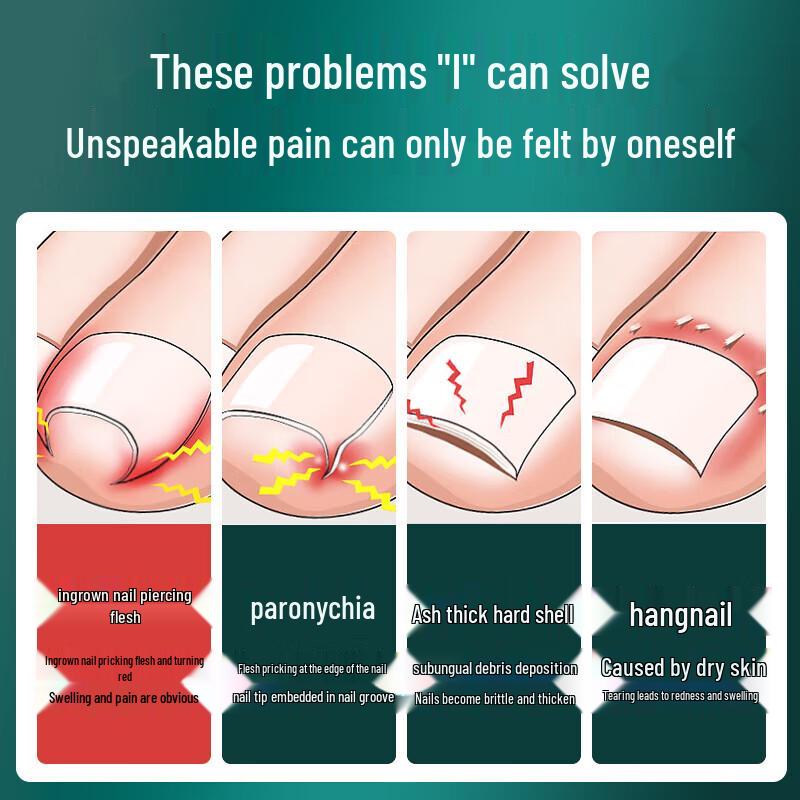 MR.GREEN Benőtt lábkörömvágó készlet