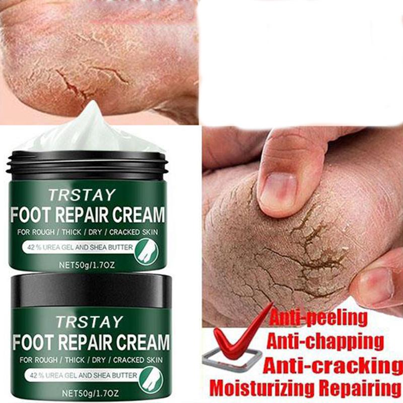 

Питательный крем против растрескивания, лечение запаха, средства по уходу за кожей, средство для удаления омертвевшей кожи, потрескавшийся восстанавливающий крем