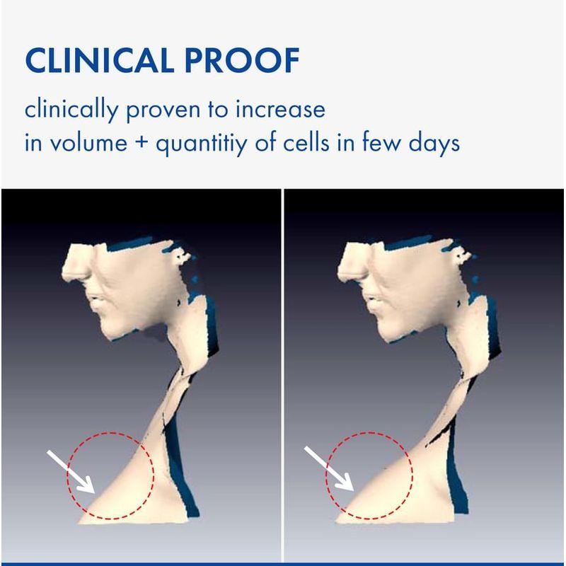 TOSOWOONG Volufiline 100% Botanic Oil
