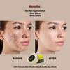 Mezco Pimple & Scar Removal Cream Controls Acne Spot & Pimples Pigmentation Removing Daily Skin Moisturizer for Girl's (Yellow) (Pack Of 1)