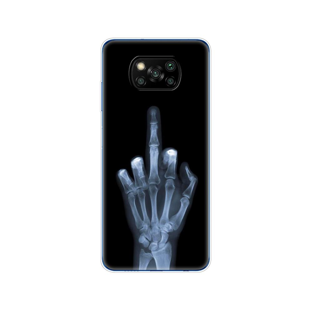 

Для Xiaomi Poco X3 NFC силиконовый чехол с мягкой задней панелью для POCO X3 Pro чехол из ТПУ, бампер для Poco X 3 PocoX3 NFC 6,67 дюйма, глобальный чехол для телефона POCO X3 Pro