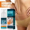 Scar Gel for Face Body Skin Care Scar Treatment for Both Old And Scars 50ml Make Scars Smaller & Less Visible Body Creams