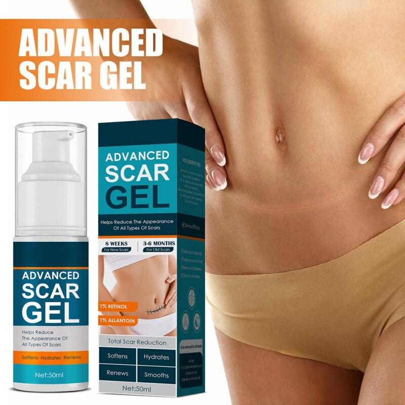 Scar Gel for Face Body Skin Care Scar Treatment for Both Old And Scars 50ml Make Scars Smaller & Less Visible Body Creams