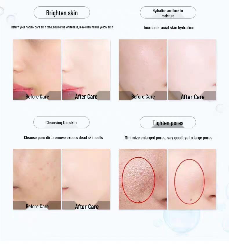 Hydrating Beauty Device: Ice & Heat Compress, Electroporation, Oxygen Injection for Skin Rejuvenation