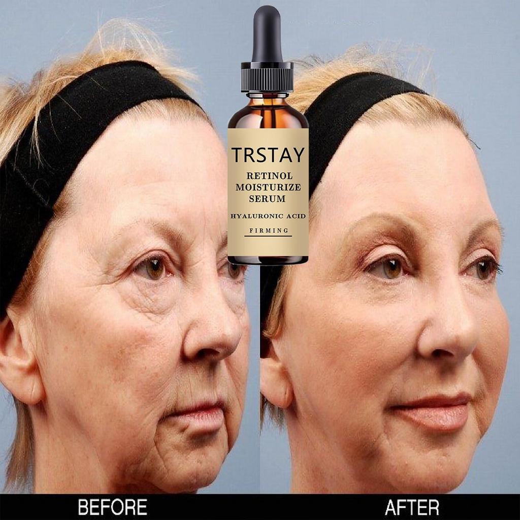 New 100% Pure Natural Vitamin E Oil Face Body Massage Spa Avocado Essential Oils Cold Pressed Moisturizer Serum