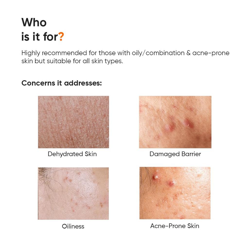Minimalist Dehydrated Skin Moisturizer 10% Vitamin B5 Oil-Free Hydration Lightweight Gel For Oily Acne-Prone Skin Damaged Barrier Repair 50g