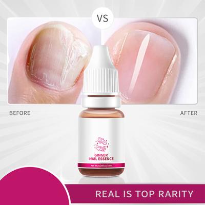 10ml Nagelserum für rissige und beschädigte Nägel, Nagelhaut, wirksames Nagelserum
