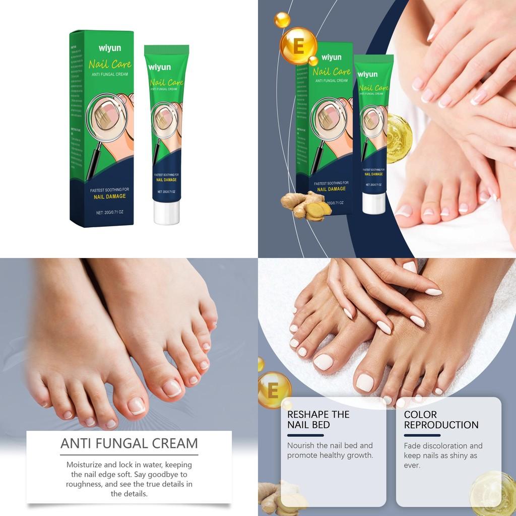 Nourishing Wiyun Nail Care Repair Cream For Glossy Shine And Comforting Relief