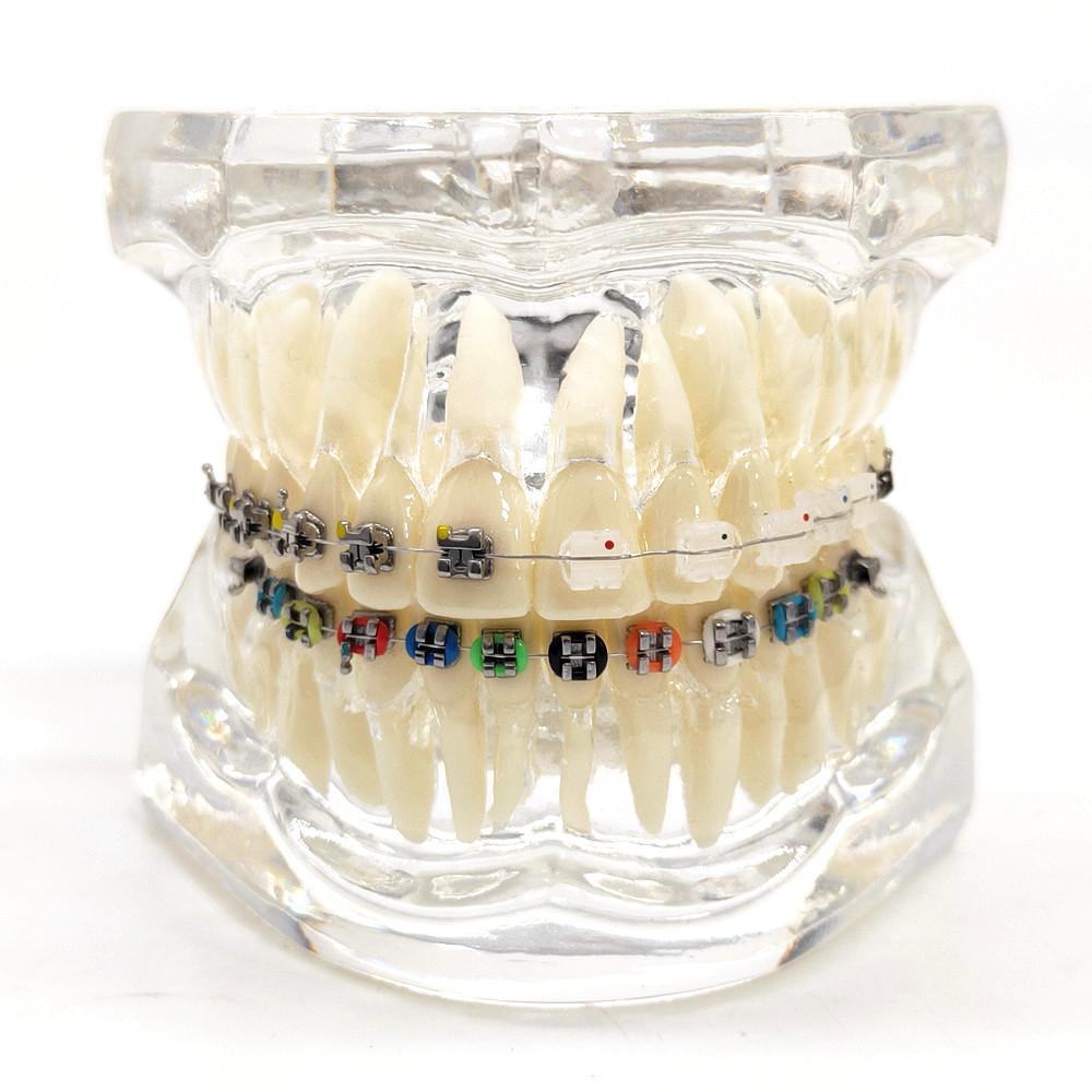 

Стоматологическая ортодонтическая модель зубов, 4 вида кронштейнов, керамические и металлические брекеты для общения с пациентом, модель стоматологического исследования 1 piece C чистый