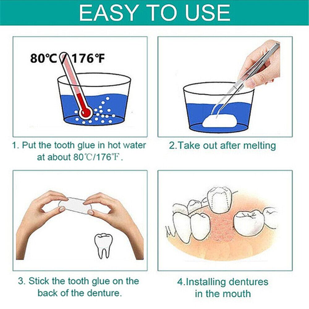 1 Bag/100Pcs Dental Temporary Crown Veneers for Anterior Front Teeth Whitening