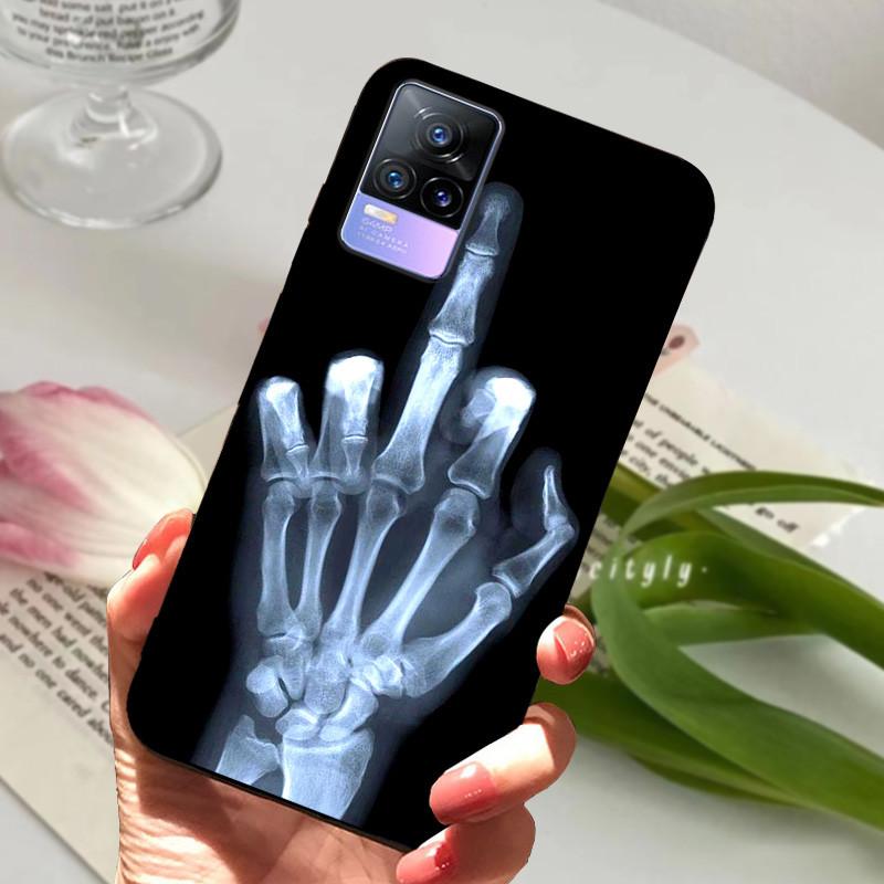 For Vivo V21e Case V 21e V2061 V2055 Soft TPU Phone Protective Fundas Cover For Vivo V21 V 21 4G 5G Shockproof Bumper Shells