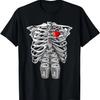 Top – T-shirts