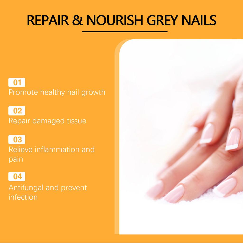 South Moon Nährendes Nagelpflegespray Für Starke Und Glänzende Nägel 100ml Feuchtigkeitsspendende Behandlung