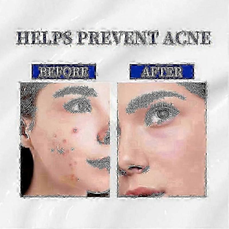 A-313 Vitamin A Retinol Creme 2X Retinol Anti-Aging Gesichtscreme, Reduziert Falten & Poren, Mildert Dunkle Flecken & Aknenarben, 50ml