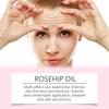 Rosehip Seed Facial Oil Deeply Hydrates, Moisturizes And Nourishes The Skin, Providing Long-lasting Nourishment And Anti-aging Plant Oil60ml