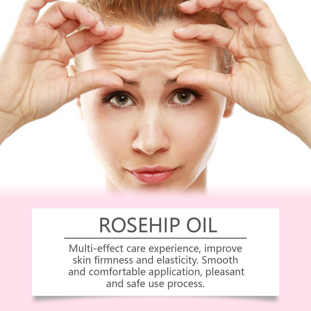 Rosehip Seed Facial Oil Deeply Hydrates, Moisturizes And Nourishes The Skin, Providing Long-lasting Nourishment And Anti-aging Plant Oil60ml