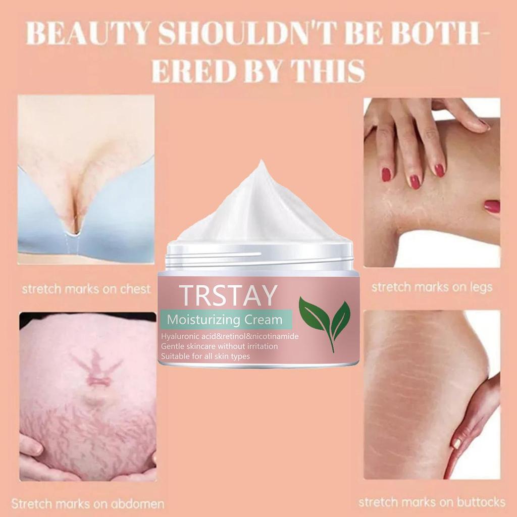Gentle and Non-irritating, the Smoothing Skin Stretch Mark Cream Smooths Wrinkles, Fades Fine Lines, and Leaves Skin Soft and Refined