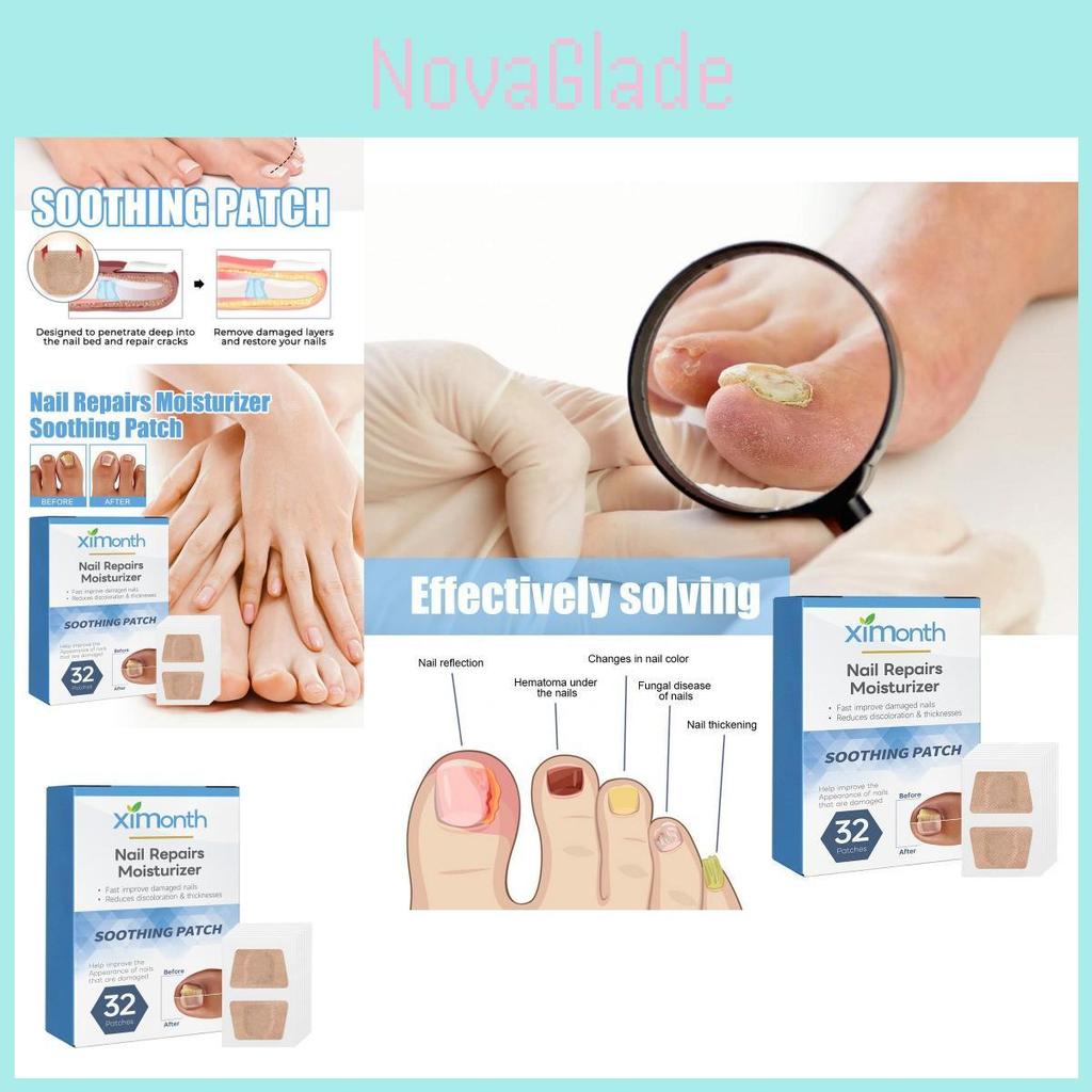Ximonth Nagelreparatur-Pflaster Weiches Gel Verdickende Nagelpflege Zur Behandlung von Pilzinfektionen