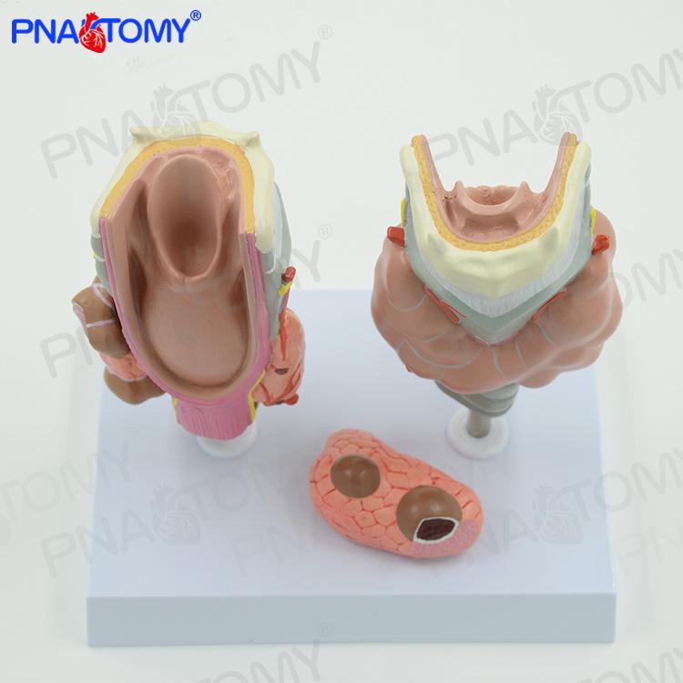 Thyroid and Larynx Medical Anatomy Model: Hyperthyroidism & Hypothyroidism 16.5 x 12.5 x 2.5 cm