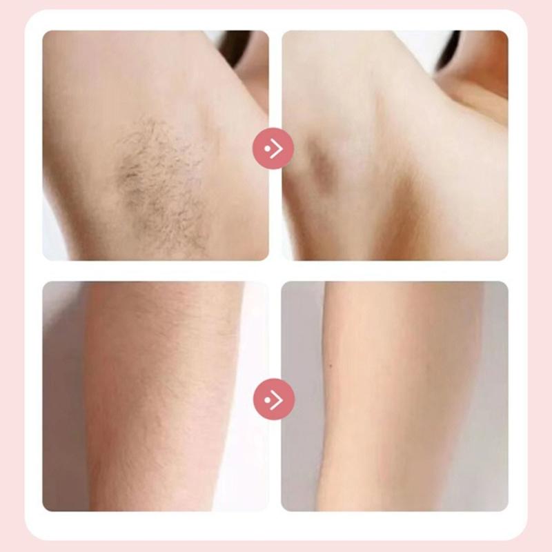 Bikini Trimmer for Women Pubic Hair Trimmer Body Groomer Electric Shavers for Pubic Arms Leg Underarm Hair Removal