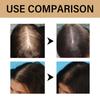 Hoegoa Onion Biotin Shampoo (With Rosemary Extract) 200ml, Anti-Hair Loss, Scalp Care, Promotes Hair Growth, Strengthens & Thickens Hair