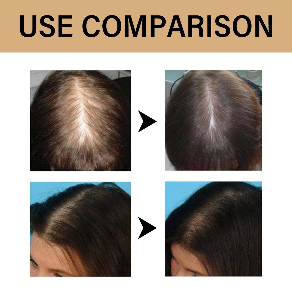 Hoegoa Onion Biotin Shampoo (With Rosemary Extract) 200ml, Anti-Hair Loss, Scalp Care, Promotes Hair Growth, Strengthens & Thickens Hair