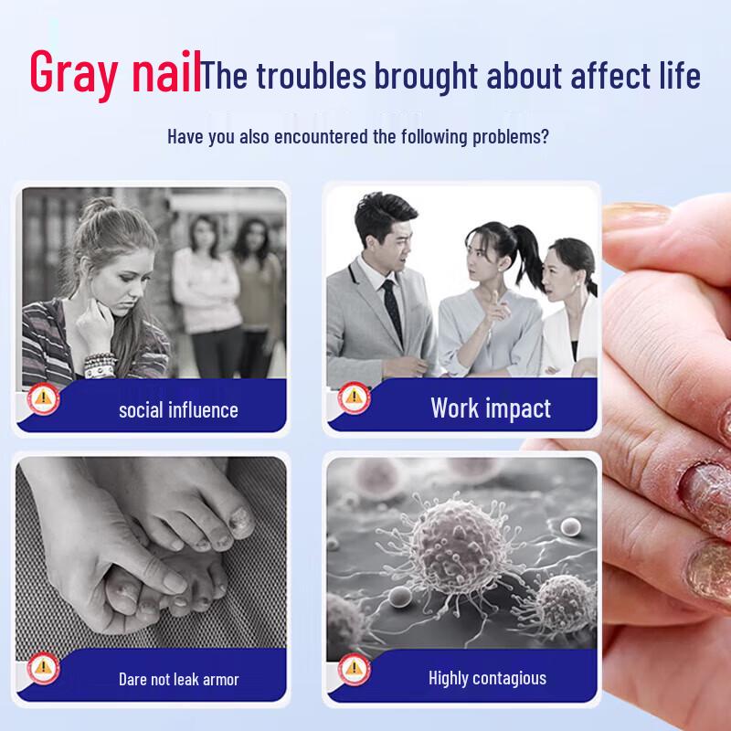 Tong Ren Tang Fungal Nail Repair Solution