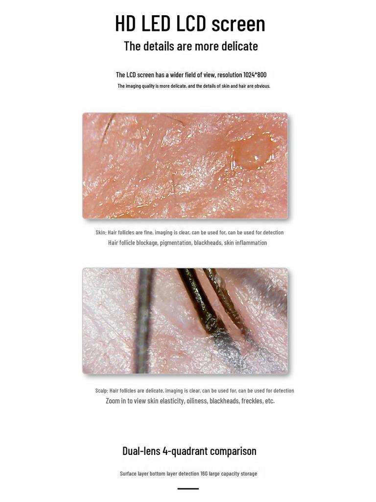 High-Definition Smart Scalp & Skin Detector with Hair Follicle Analysis