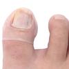 2pcs Silicone Ingrown Toenail Correcting Tool Pain Relief Paronychia Treatment Corrector