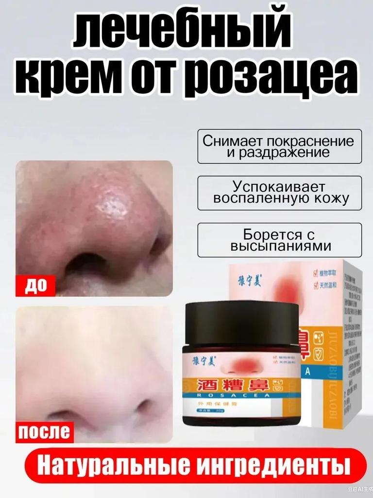 Spezialpflaster für Rosacea rote Nase Erdbeernase