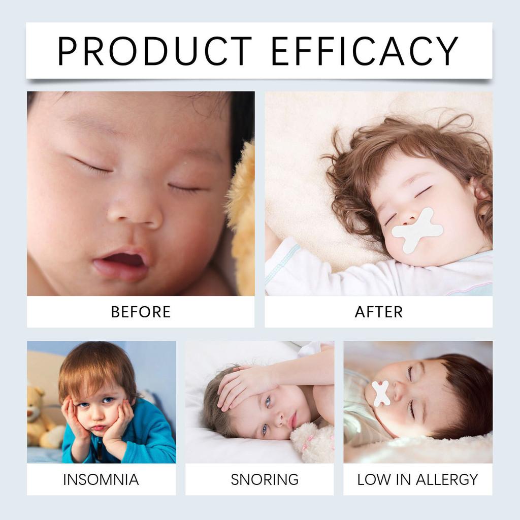 Wiieey Children Snore Patches For Comfortable And Peaceful Nighttime Sleep Aid