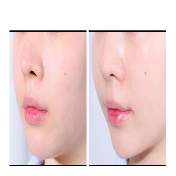 ISNTREE Serum Hyper Niacinamid 20 20ml