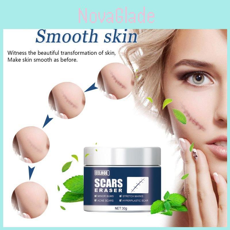 Effective Eelhoe Scar Repair Gel For Reducing Surgical And Burn Scars On Skin