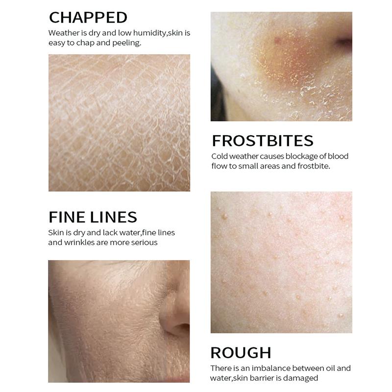 Fade Freckle Creams Anti-wrinkle Moisturizing Whitening Face Cream Hyaluronic Acid Deduce Wrinkles Facial Gel