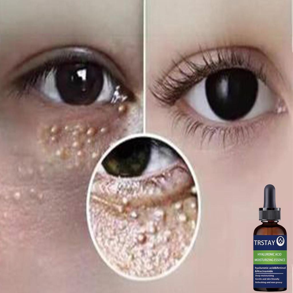 5ML/15ML/30ML/50ML/Eye Essence The Latest Hyaluronic Acid Essence Skin Care Deep Facial Anti-aging