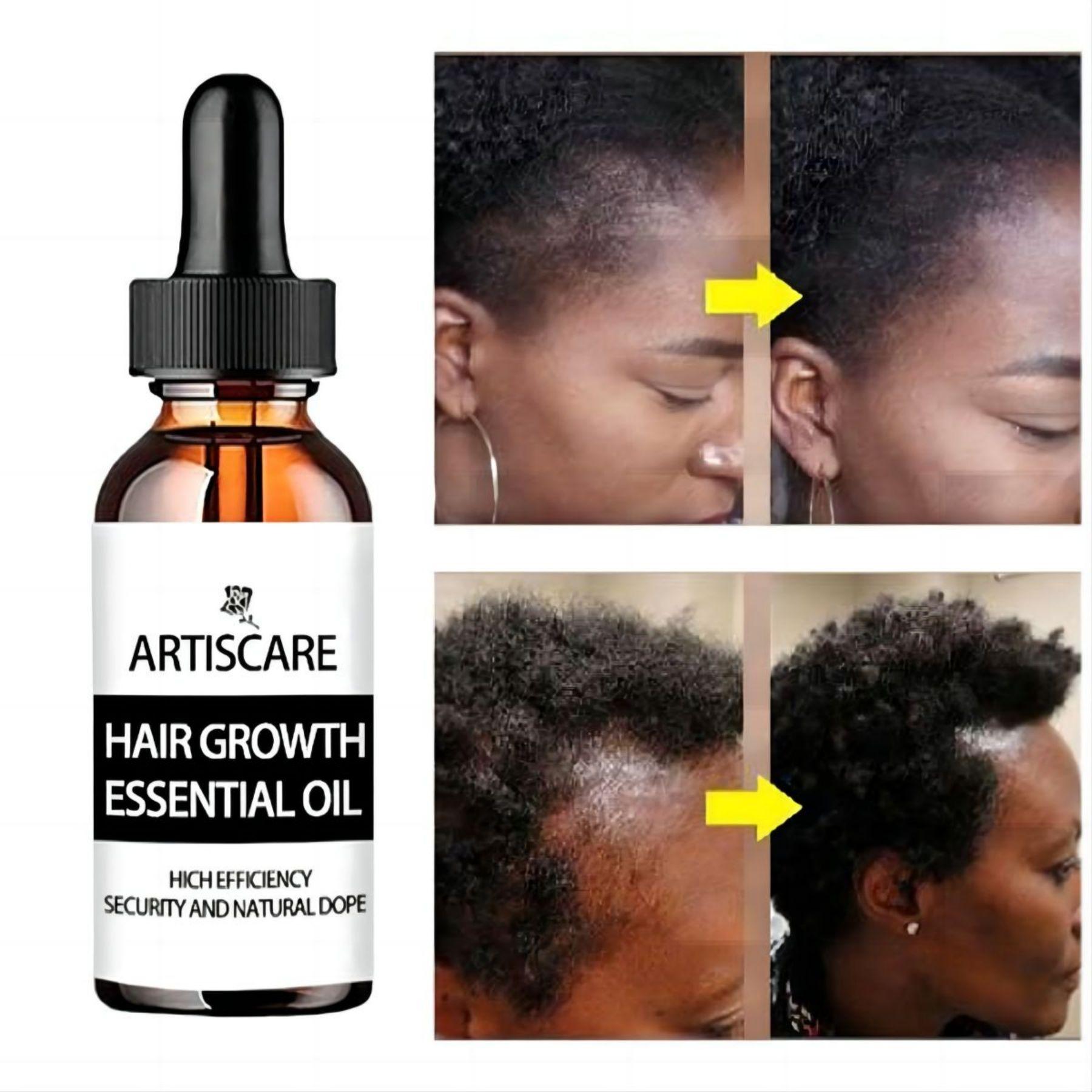 

5 мл/15 мл/30 мл/50 мл эссенция для роста волос имбиря, масла, продукты против выпадения волос, быстрорастущая зародышевая сыворотка Preve