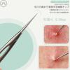 Acne Needle Blackhead Removal Blackhead Comedo Acne Removal Pore Care Acne Beauty Tool Cell Needle 1 Cell Kit, 2-Piece Set, Tool, Pusher, Extractor,