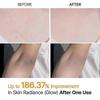 Peel Shot Keratins Care Kojic Säure Kurkuma Peeling Spray für dunkle Flecken Aufhellende Haut Tägliche Anwendung