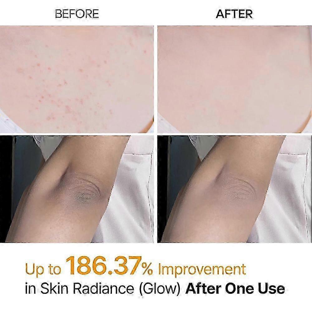 Peel Shot Keratins Care Kojic Säure Kurkuma Peeling Spray für dunkle Flecken Aufhellende Haut Tägliche Anwendung