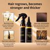 Cross-border Europe & America Hair Growth Spray: Anti-Hair Loss, Deep Nourishing Essential Oil