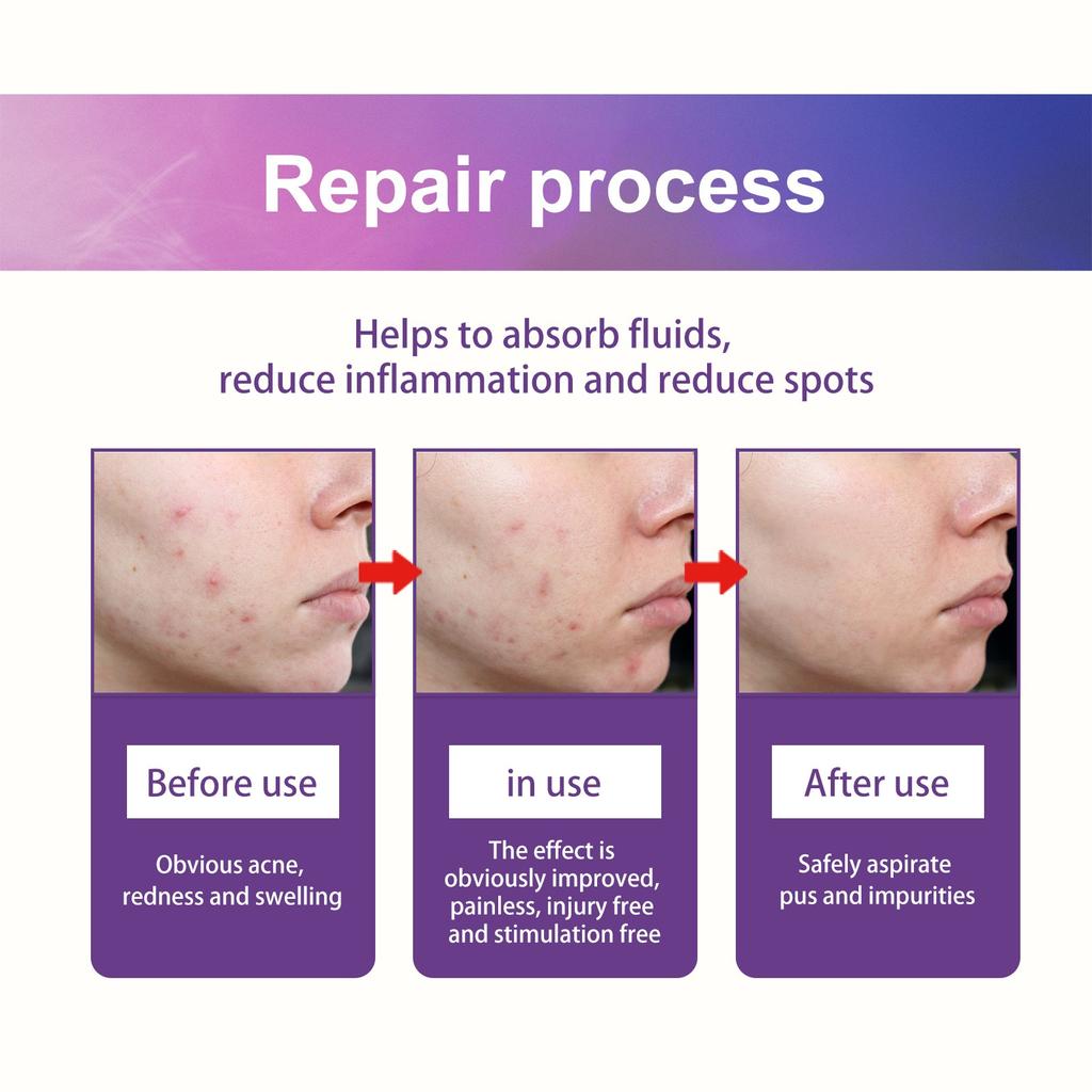 Marine Skin Care Acne Patches For Face, Colorful Pattern Zit Covers,Hydrocolloid Acne Patches With Tea Oil,Green Varec Extract Ect.(144 Count)