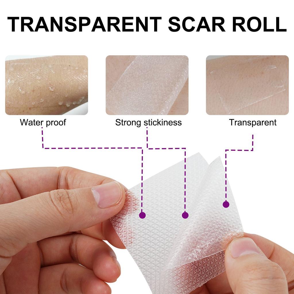 1 Roll Invisible Silicone Scar Sheets , 4cmX150cm Self-Adhesive Scar Cover Tape Skin Care Strips , Transparent Color