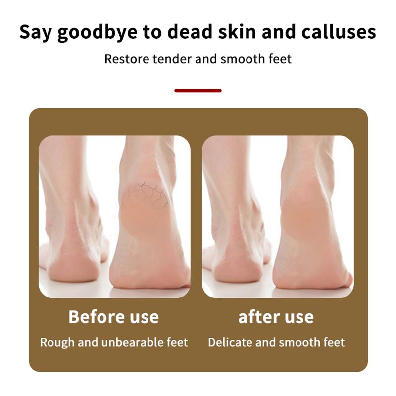 Pedicure Tools Heel Scratcher Files Artifact Exfoliating Calluses Brush Stainless Steel Foot Sharpening Double-Sided Pedicura