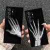 Funny X-Ray Hand Bones Soft Phone Case for Samsung Galaxy S26 S25 Edge S24 Ultra S23 Plus S22 S21 FE S20 Black Cover Back Shell
