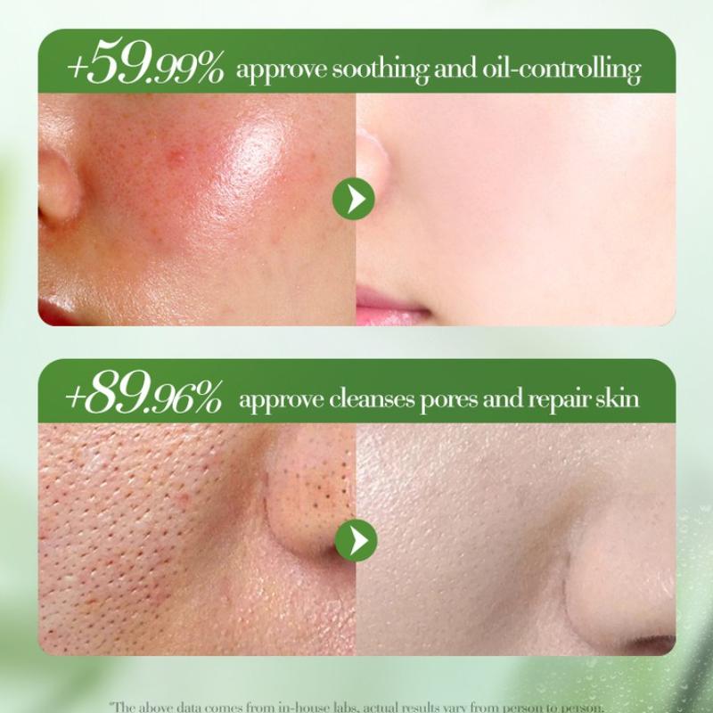 Hypoallergenic Aloe Vera Gel Facial Cream Moisturizing Hydrating Deep Skincare for Men Women All Skin Types